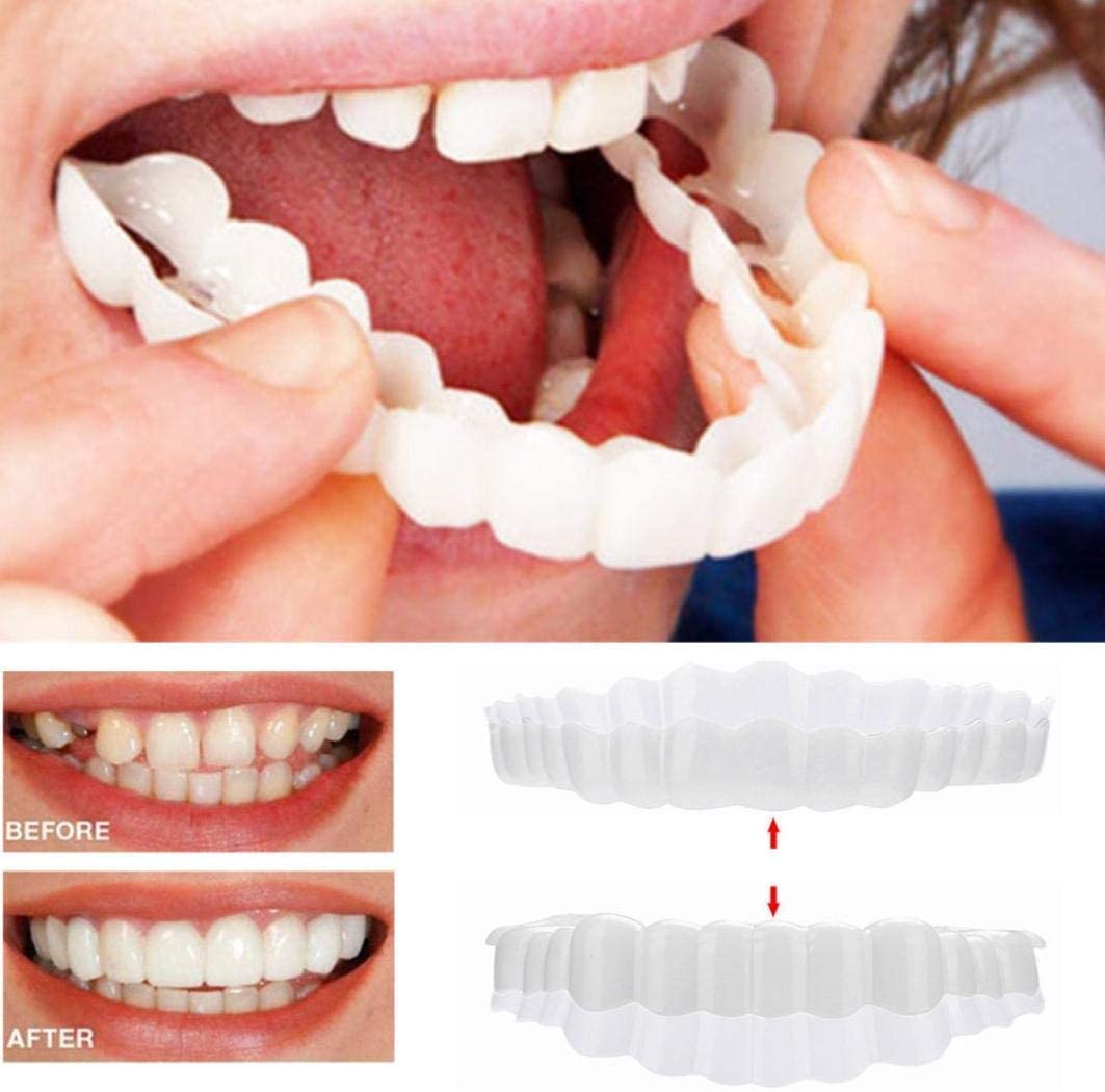 Allure Smile Veneer (Upper & Lower Included)