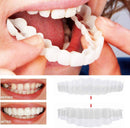 Allure Smile Veneer (Upper & Lower Included)