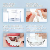 Allure Smile Veneer (Upper & Lower Included)